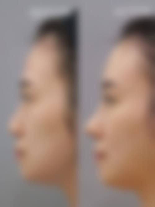 九、南昌市第一医院整形美容科真实的患者评价