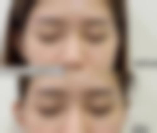 九、台州奥拉克医疗美容整形门诊部真实的患者评价