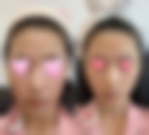 八、台州奥拉克医疗美容整形门诊部预约方式