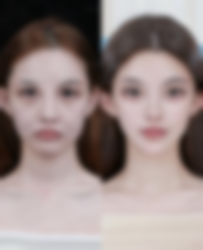 三、小腿抽脂手术的风险