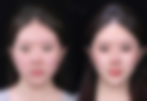 二、台州奥拉克医疗美容整形门诊部怎么样？