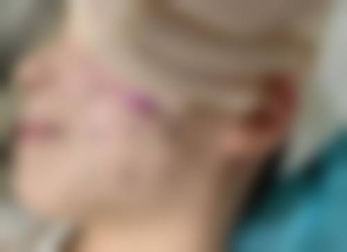 四、南昌优壹美（原千伊美）医疗美容门诊部特色项目