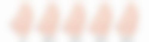 一、割眼袋眼睛青了一圈的原因