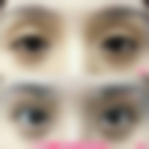 四、韩国 Avant 整形特色项目