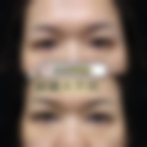 八、南昌优壹美（原千伊美）医疗美容门诊部真实的患者评价