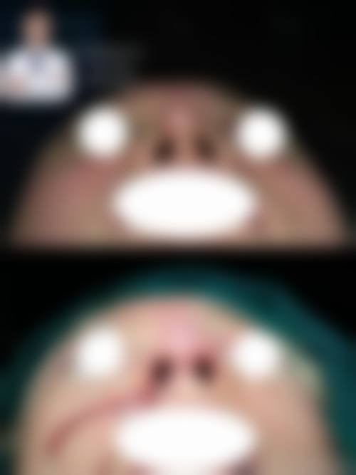 八、韩国 Avant 整形真实的患者评价