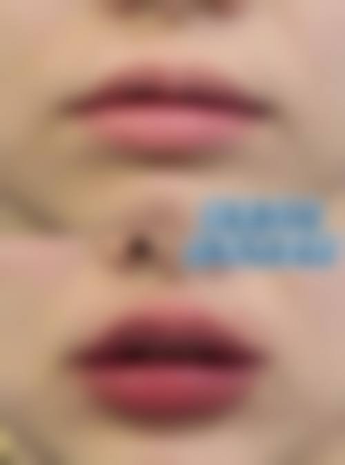 四、衡东金典美集医疗美容诊所特色项目