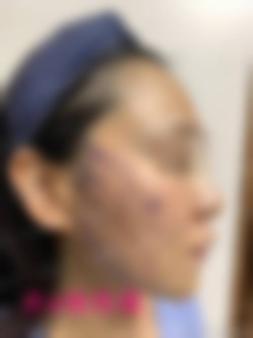 二、惠州星泷整形医院怎么样？