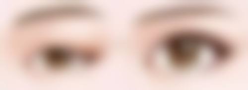 一、了解眼袋形成原因