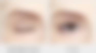 七、术后注意事项