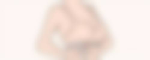 四、疤痕修复的特殊情况及处理方法