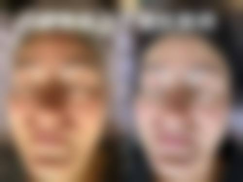 九、深圳康盈美整形美容医院真实的患者评价