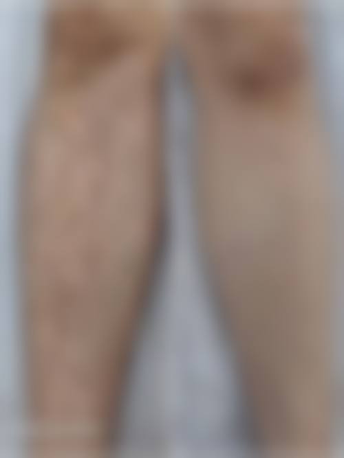 八、深圳康盈美整形美容医院预约方式