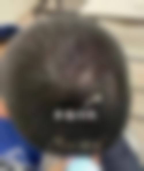 四、深圳康盈美整形美容医院特色项目