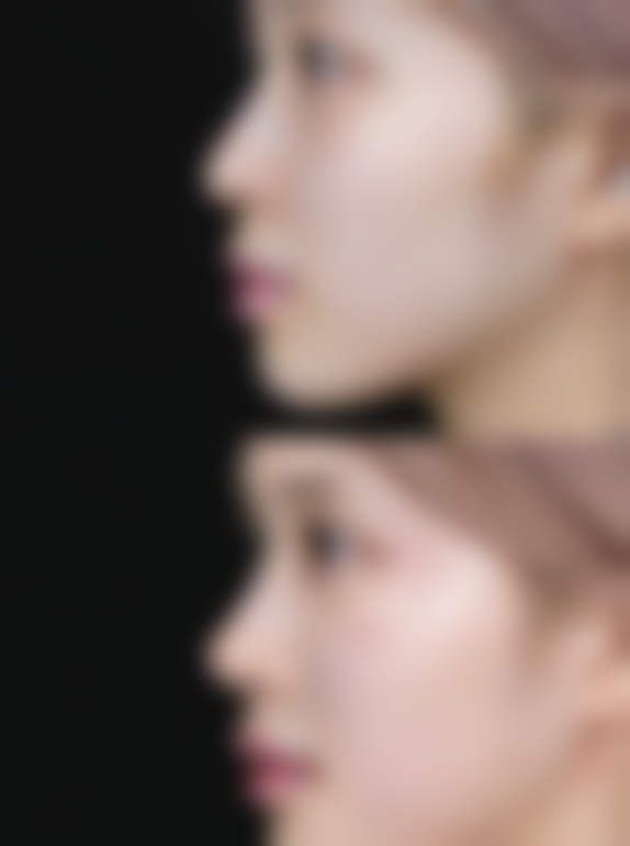 黄瓜可以除眼袋吗？了解其作用与局限，科学应对眼袋问题有妙招 