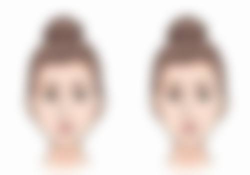 三、软黄金隆鼻的优势