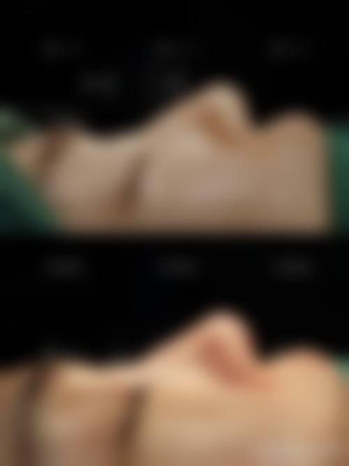 四、佛山禅城明兮和本整形医院特色项目