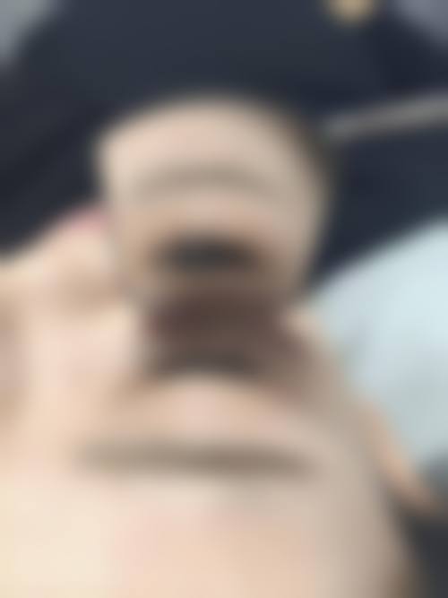 六、亢赛真实的患者评价