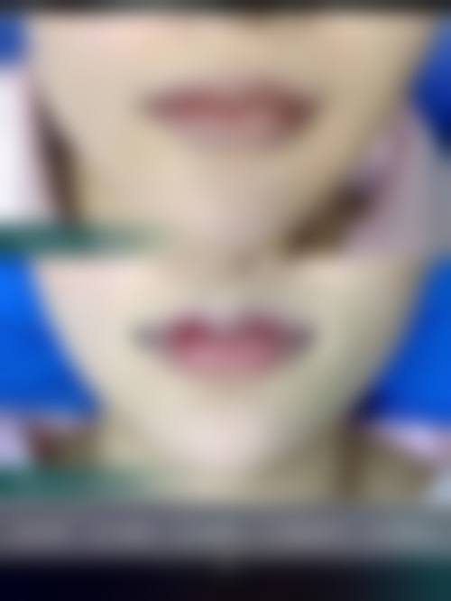 八、佛山禅城明兮和本整形医院真实的患者评价