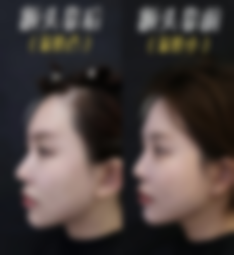 四、不同治疗方案对比