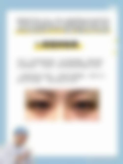 四、武汉熙蒙整形医院特色项目