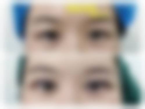 八、武汉熙蒙整形医院真实的患者评价