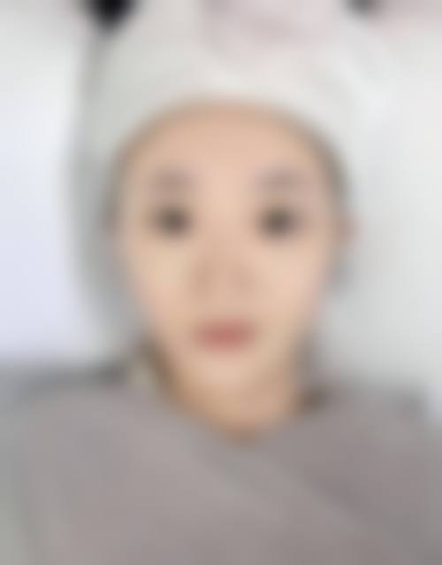 四、池州佳美皮肤美容医院特色项目