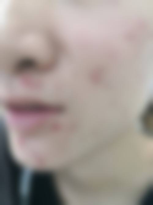 六、任爽真实的患者评价