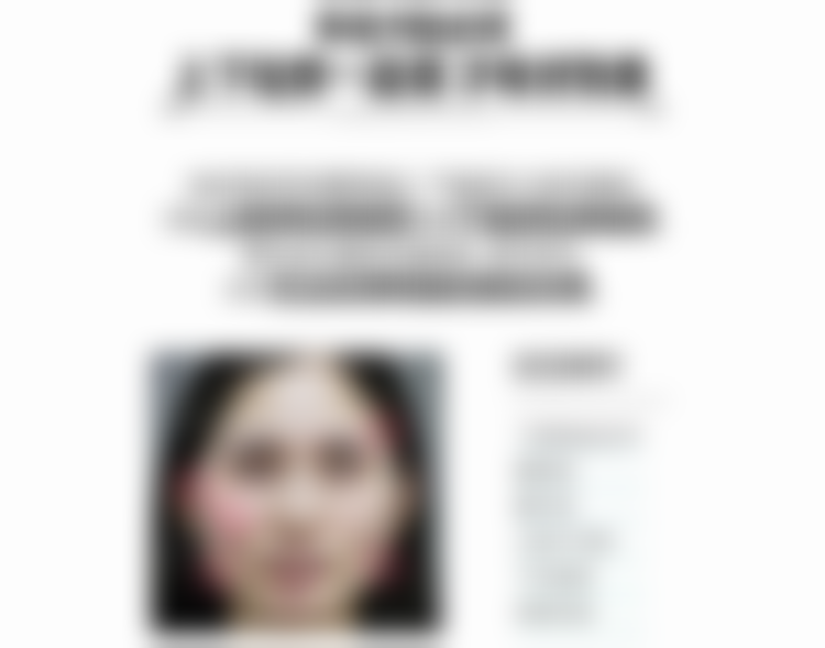 四、北京圣嘉新医疗美容医院乐普悦雅颜聚乳酸面部填充的实例展示