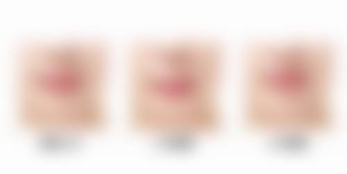 二、龙岩朝晖美容整形诊所怎么样？