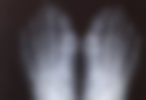 二、不同修复阶段能否戴美瞳及注意事项