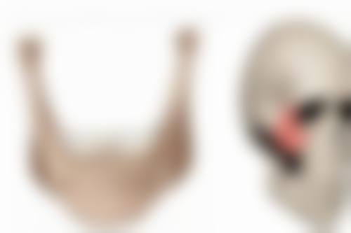 三、皮肤烫伤疤痕的分型治疗方案