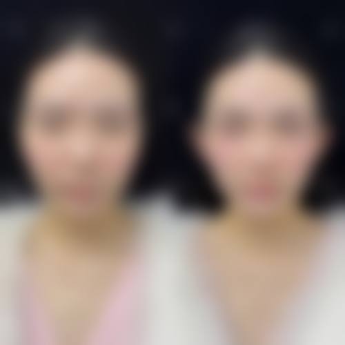 四、海口煦纳医疗美容门诊部特色项目