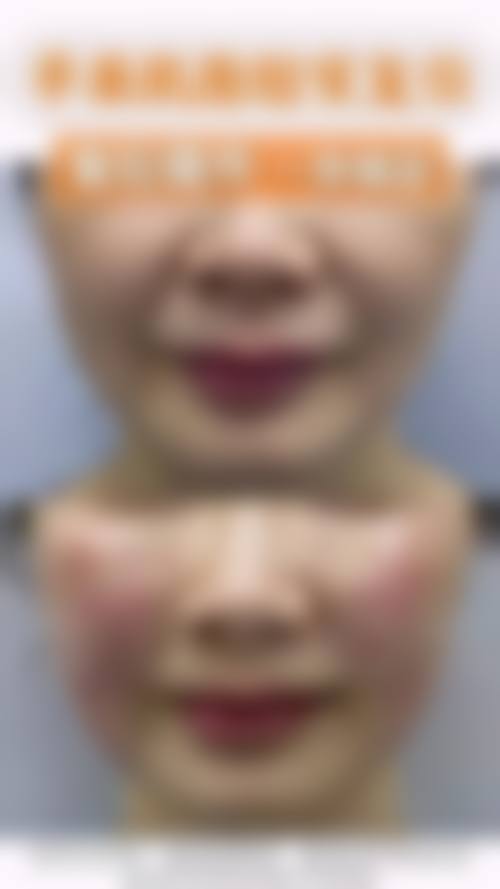 七、神木刘云霞整形医院预约方式