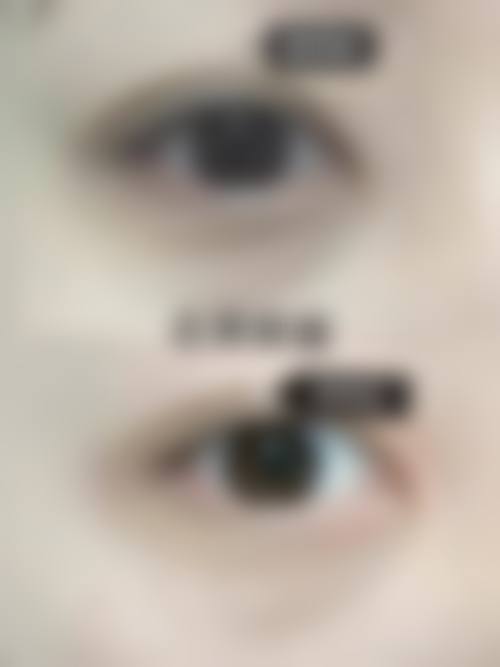 八、龙岩朝晖美容整形诊所真实的患者评价