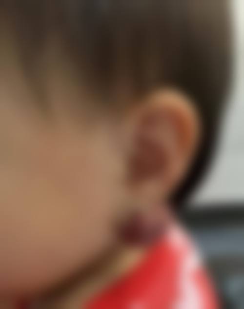 五、神木刘云霞整形医院价格表