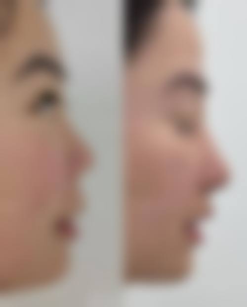 四、神木刘云霞整形医院特色项目