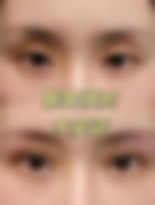 四、龙岩朝晖美容整形诊所特色项目