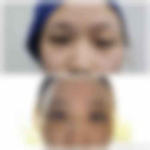 二、神木刘云霞整形医院怎么样？