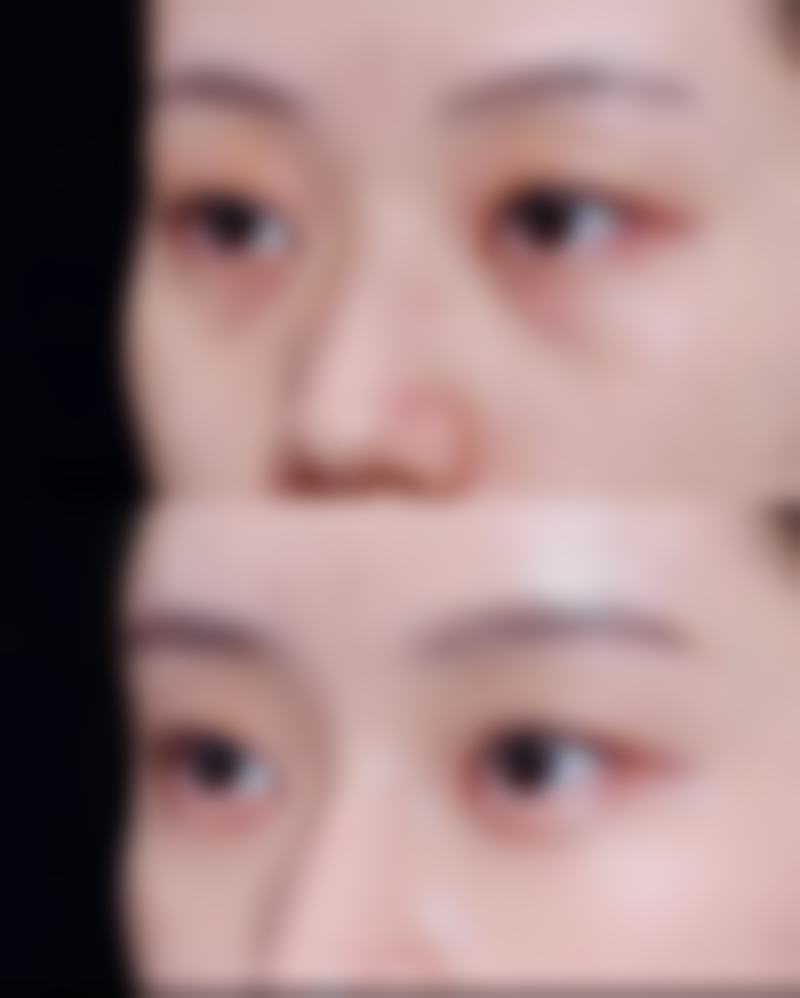 八、北海美秀中禾医疗美容门诊部真实的患者评价