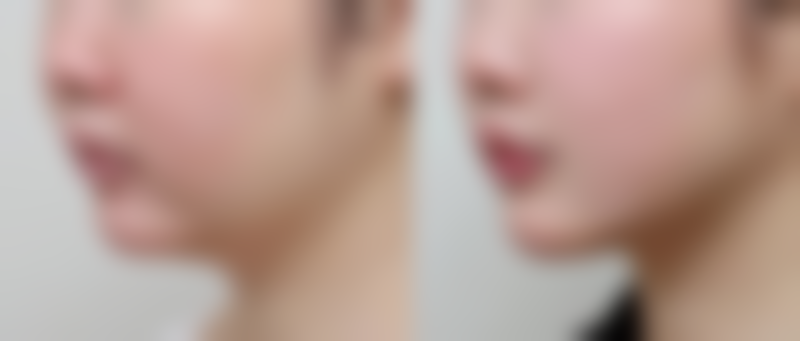 三、美学与健康提示