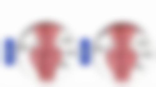 手臂吸脂多久可以拆线？了解关键时间点与护理注意事项助你快速恢复