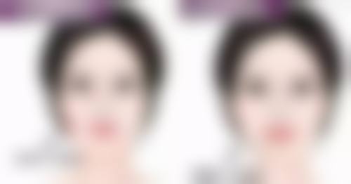 四、手臂吸脂风险提示与理性建议