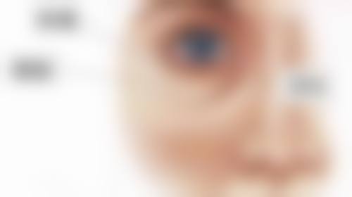 三、二次手术的条件