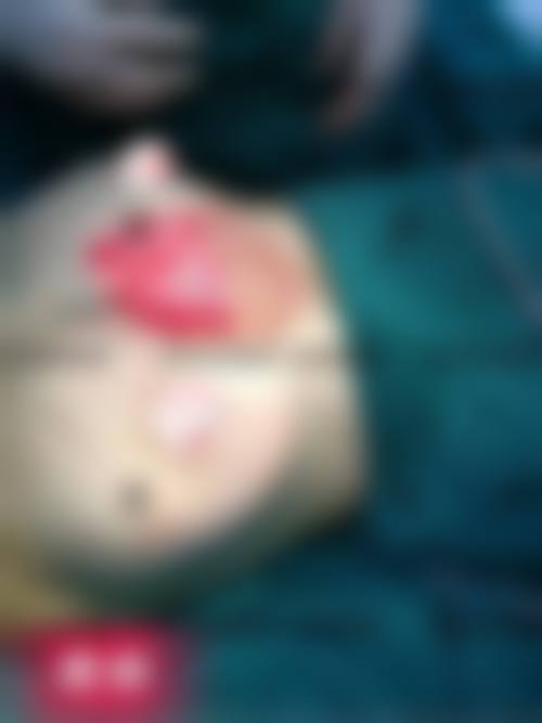 五、Rize Clinic 千叶价格表