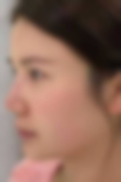 六、刘流真实的患者评价