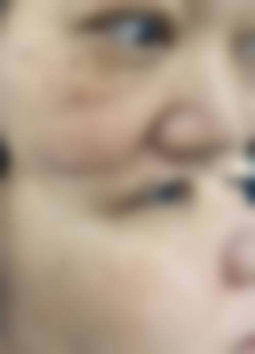 四、医療法人社団ABC芦屋美容皮肤科特色项目