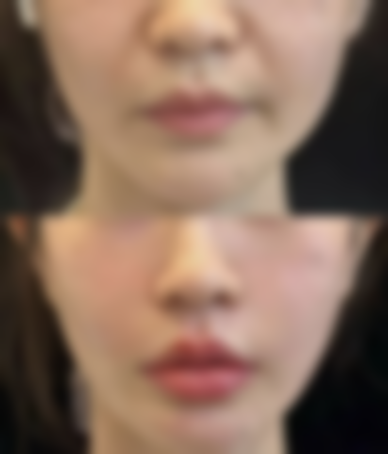 六、术后护理要点