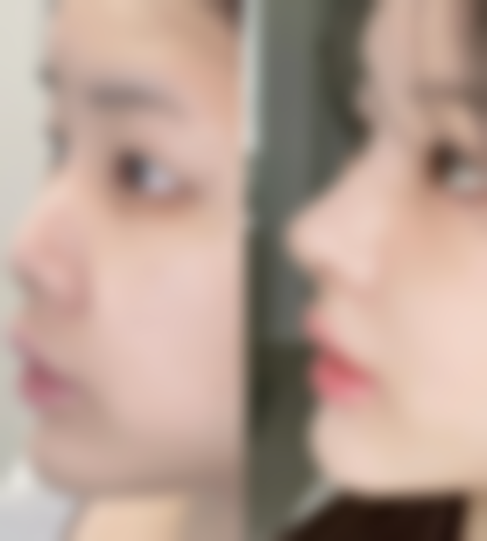 六、何林翰真实的患者评价