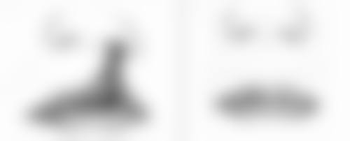 三、什么牌子瘦脸针更好？进口与国产产品的核心差异